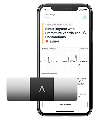 KardiaMobile Personal EKG Heart Rate Monitor – 6 Leads